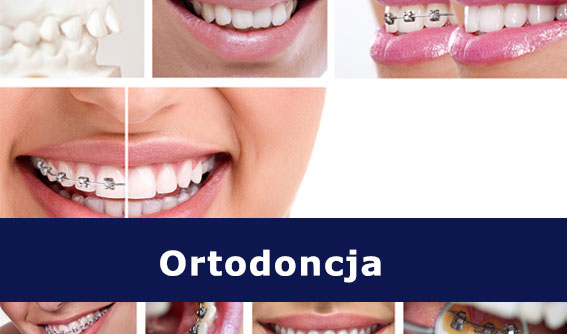 Ortodoncja leczenia wad zgryzu